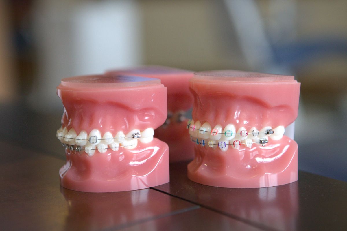 7 Tips for Brushing Your Teeth with Braces