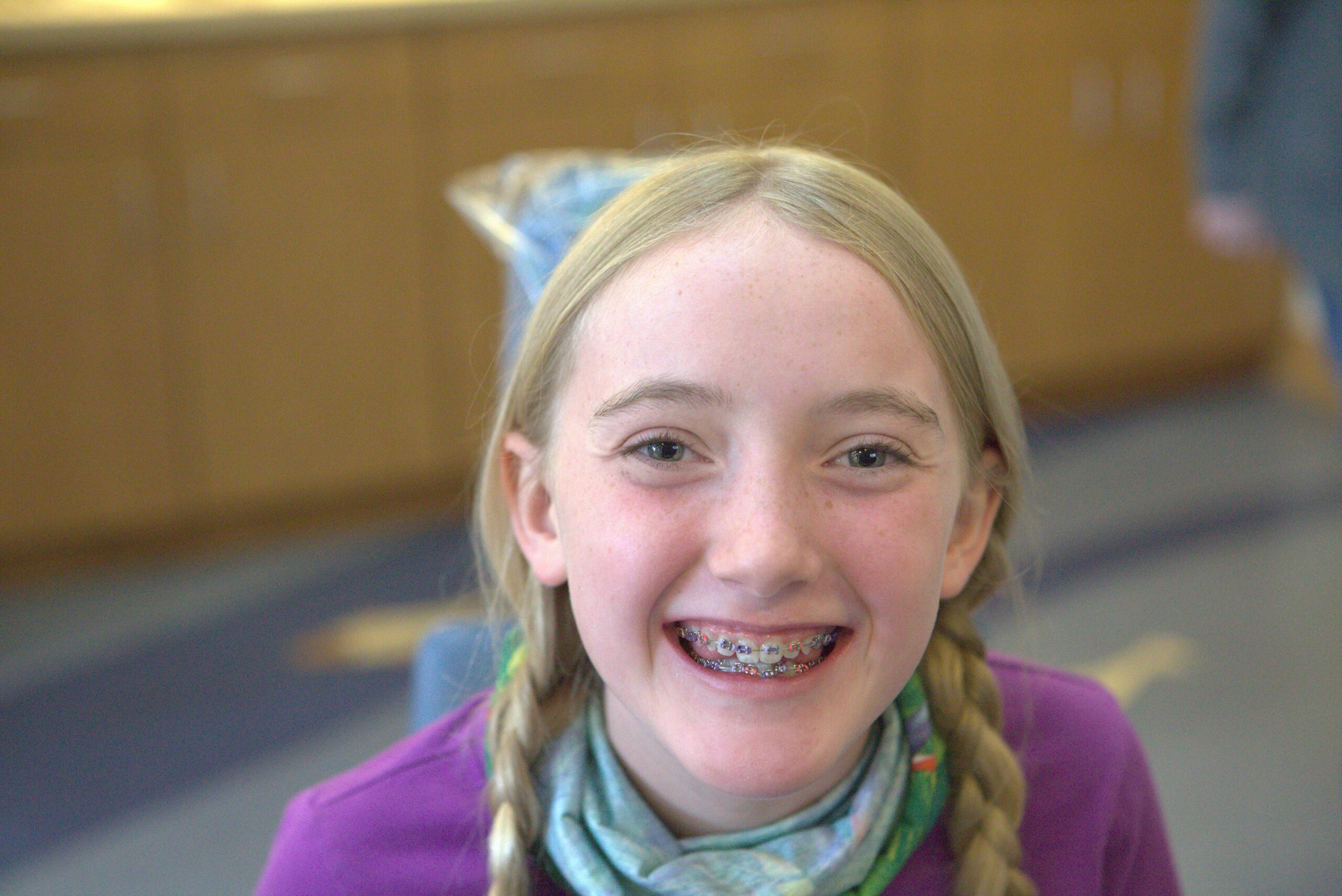 Do I Need A Tooth Extraction Before Orthodontic Treatment?